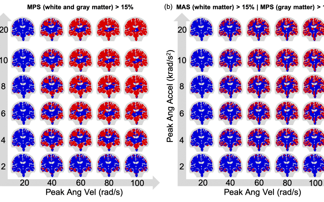 Virtual Brain Injury Study Identifies Key Factors in Potential Nerve-Fiber Damage