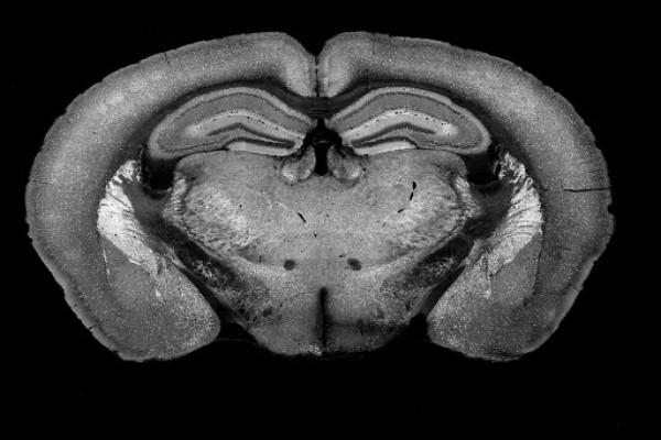 Mouse brain image showing several imaging modalities