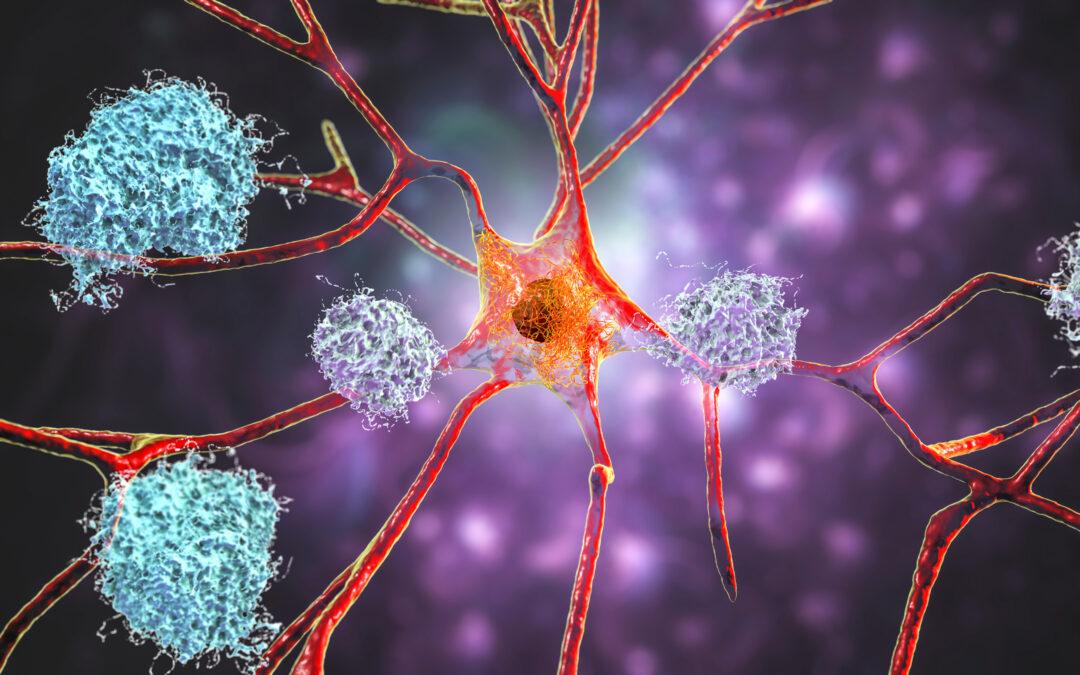 Anton Simulations Reveal How Alzheimer’s Fibril Growth May Accelerate